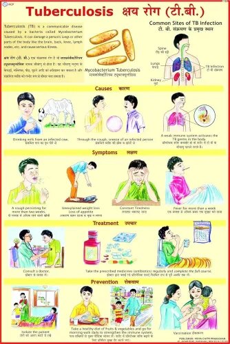 Influenza (50x70cm) product image