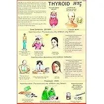 Thyroid (50x70cm) product image