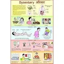 Dysentry (50x70cm) product image