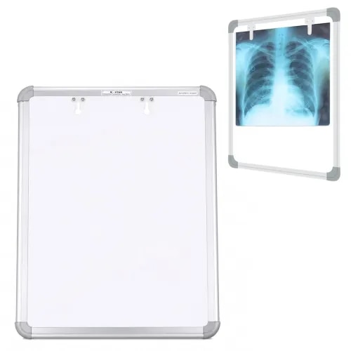 K-Star LED X-Ray Viewer Box – Slim LED X-Ray Film Viewer & Radiology Illuminator Panel