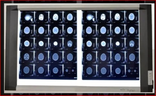 LED X-Ray View Box